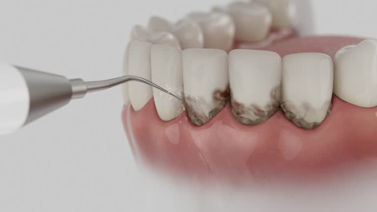 Reliable Dental Implants contractor in Pomona, CA by Smile Center Dentistry